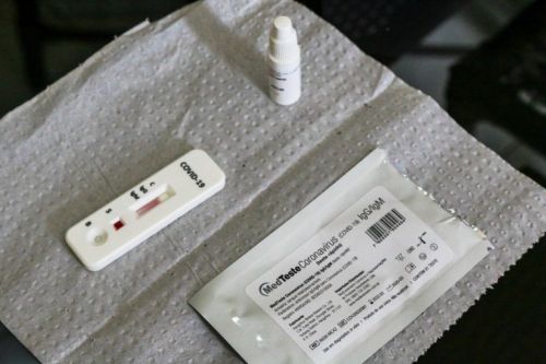Entenda tudo sobre os testes de coronavírus liberados para as farmácias