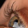 Uso errado de colírio pode provocar glaucoma
