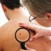 EUA aprova nova classe de medicamento contra o melanoma