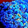 Terapia de anticorpos sintéticos contra HIV tem resultados 'promissores'