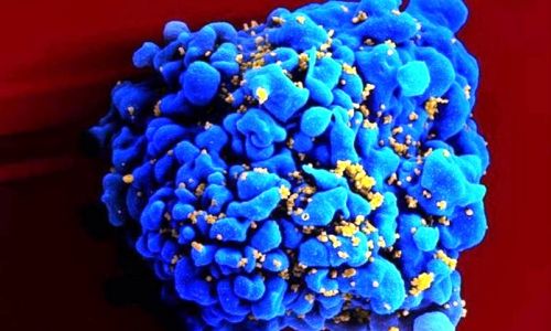 Terapia de anticorpos sintéticos contra HIV tem resultados 'promissores'