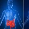 Tratamento promissor combate doença de Crohn e colite ulcerosa