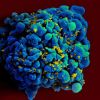 HIV: testes com nova vacina indicam proteção total contra vírus
