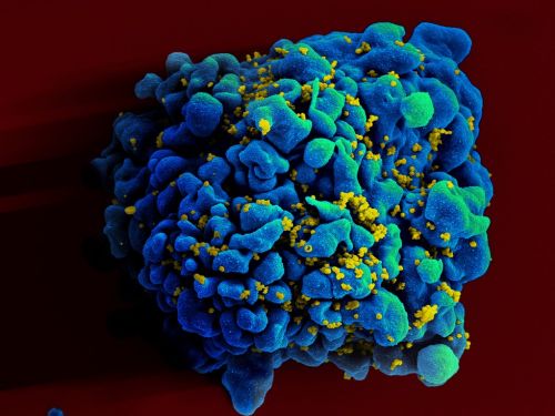 HIV: testes com nova vacina indicam proteção total contra vírus