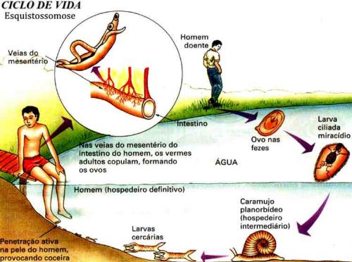 Vacina contra esquistossomose